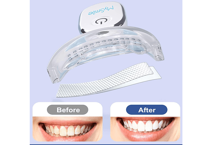 MySmile Teeth Whitening Kit