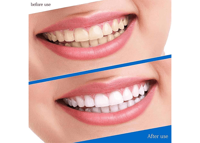 Sheer White Teeth Whitening Strips