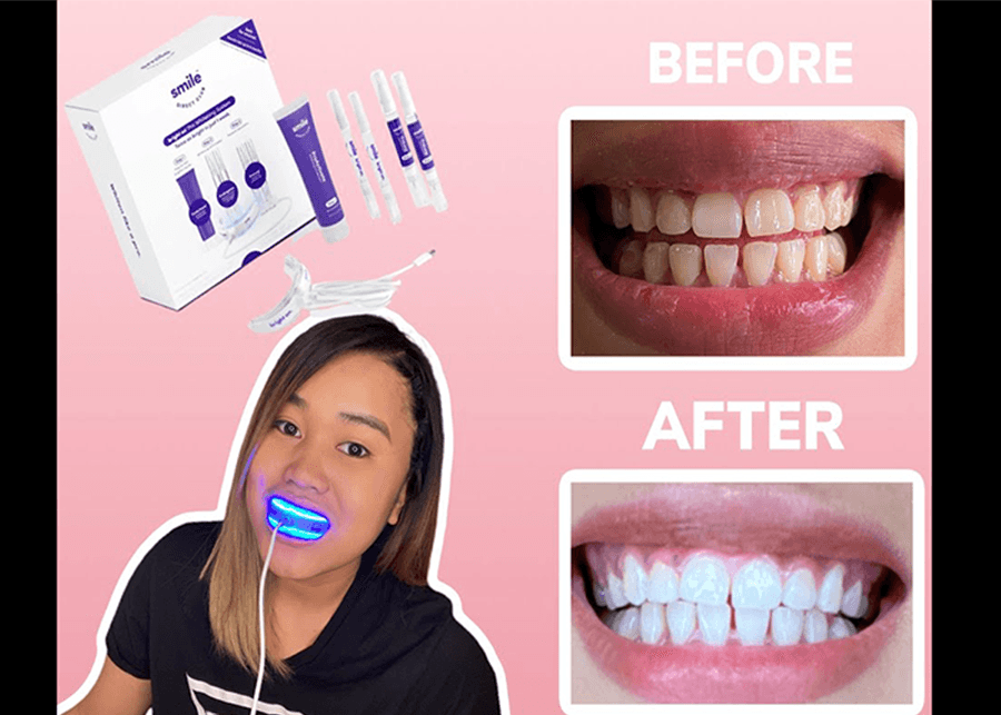 SmileDirectClub Bright Teeth Whitening Kit