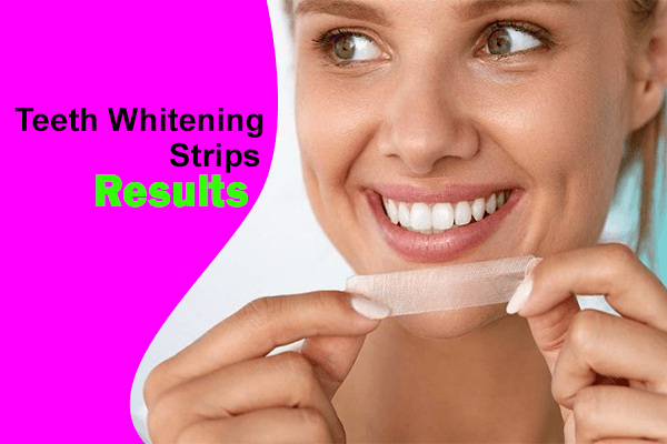 Teeth Whitening Strips Results