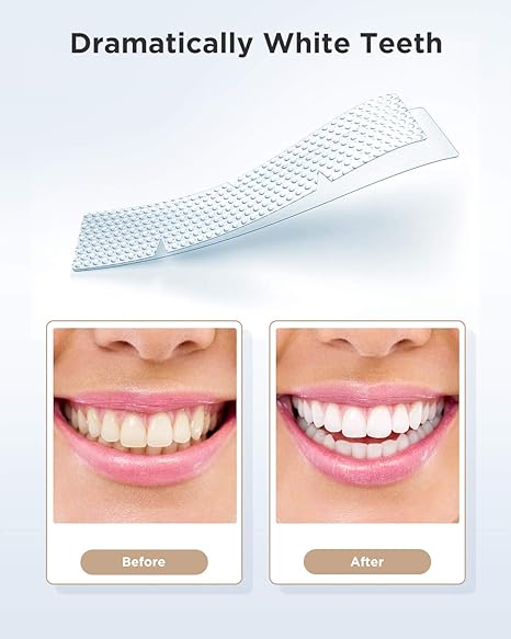 Gloridea Teeth Whitening Strips Review