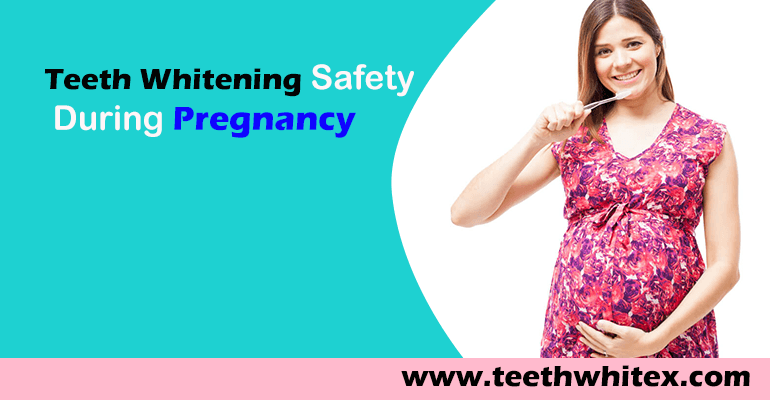 Explore The Teeth Whitening During Pregnancy