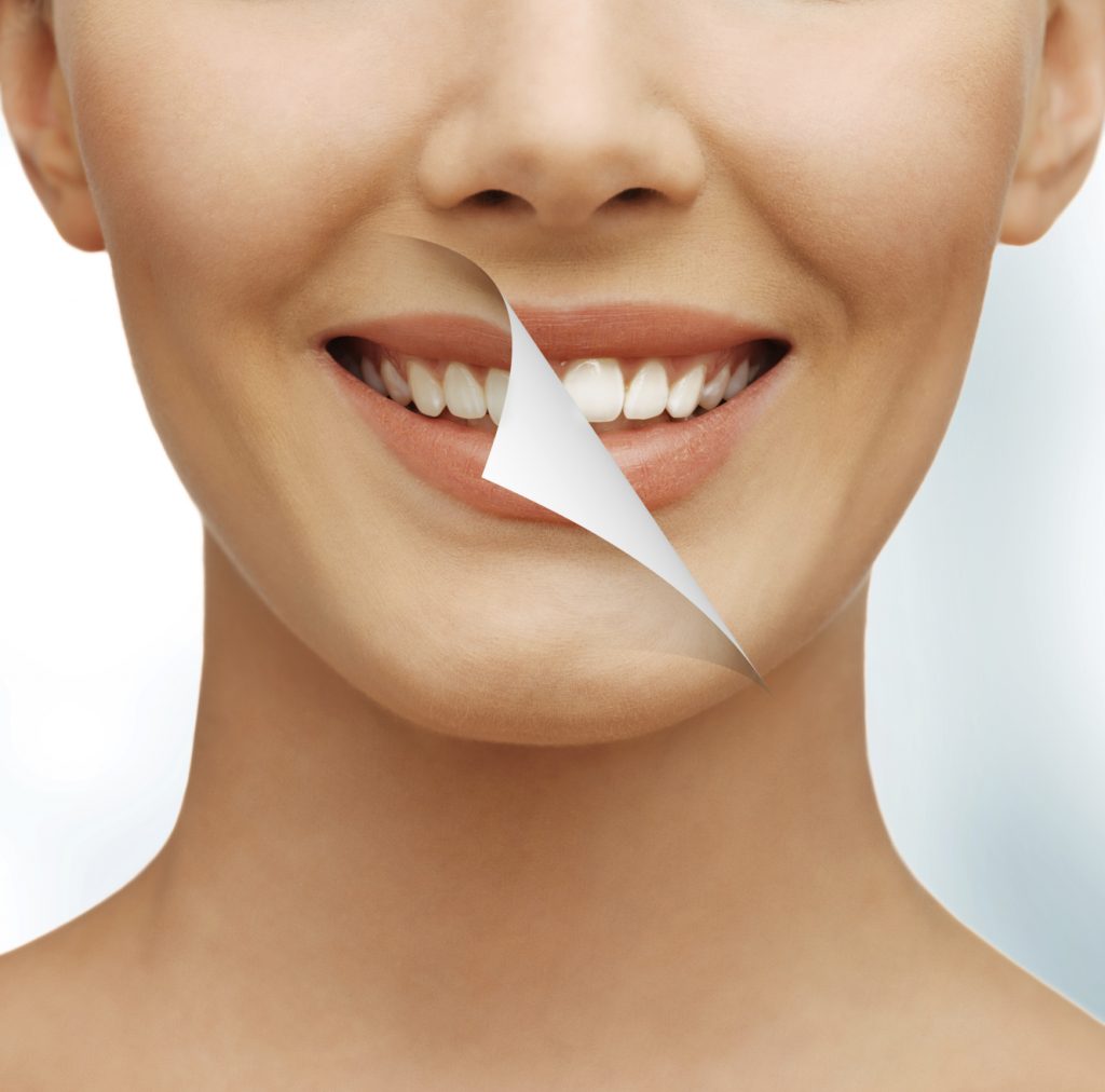 Bright White Teeth Whitening Instructions