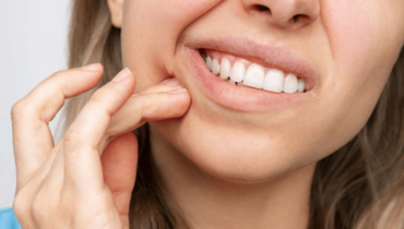 Can teeth whitening cause permanent sensitivity?