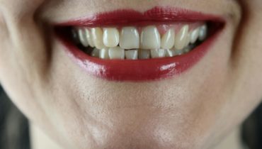 How to Rehydrate Teeth After Whitening?