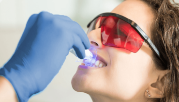 Low-Cost Teeth Whitening Clinics in Mexico 2024: Affordable Brilliance