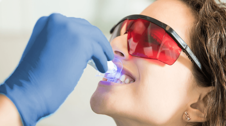 Low-Cost Teeth Whitening Clinics in Mexico 2024: Affordable Brilliance