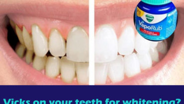 Can you put Vicks on your teeth for whitening?