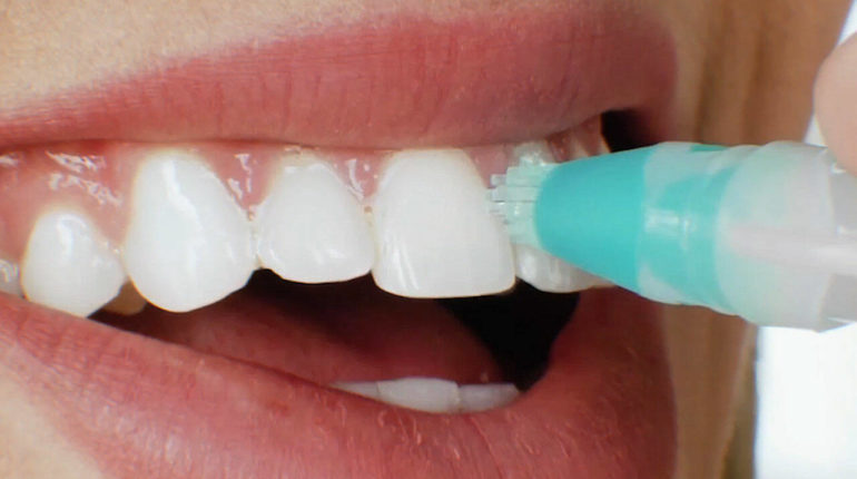 How to use teeth whitening? Tips and Tricks for Using Teeth Whitening Products Effectively